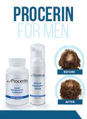  hair loss treatment for men at home